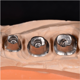 Cycle Initial en Implantologie Chirurgicale et Prothetique (11)