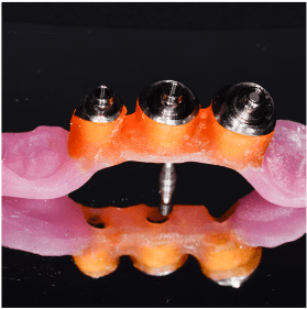 Cycle Initial en Implantologie Chirurgicale et Prothetique (13)