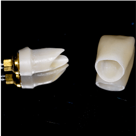 Cycle Initial en Implantologie Chirurgicale et Prothetique (16)