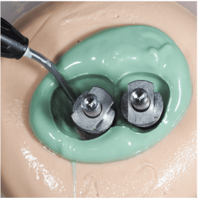 Formation Extraction Implantation IFIP (11)