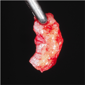 Formation Extraction Implantation IFIP (7)