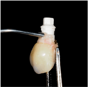 Formation Extraction Implantation IFIP (9)