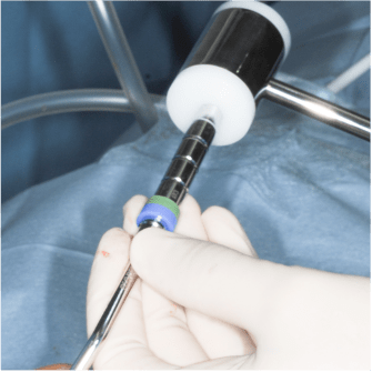 Formation IFIP comblements sinusiens Summers et Voie Laterale (8)