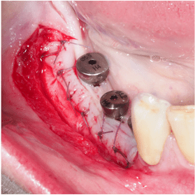 Formation IFIP tissus mous peri-implantaires (2)