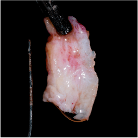 Formation IFIP tissus mous peri-implantaires (4)