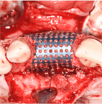 Formation Regenerations Osseuses Guidees IFIP (1)