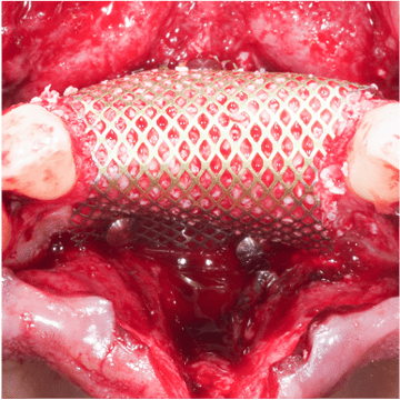 Formation Regenerations Osseuses Guidees IFIP (2)