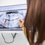 Implants dentaires : Quelles sont les contre-indications médicales à l'implantologie ?